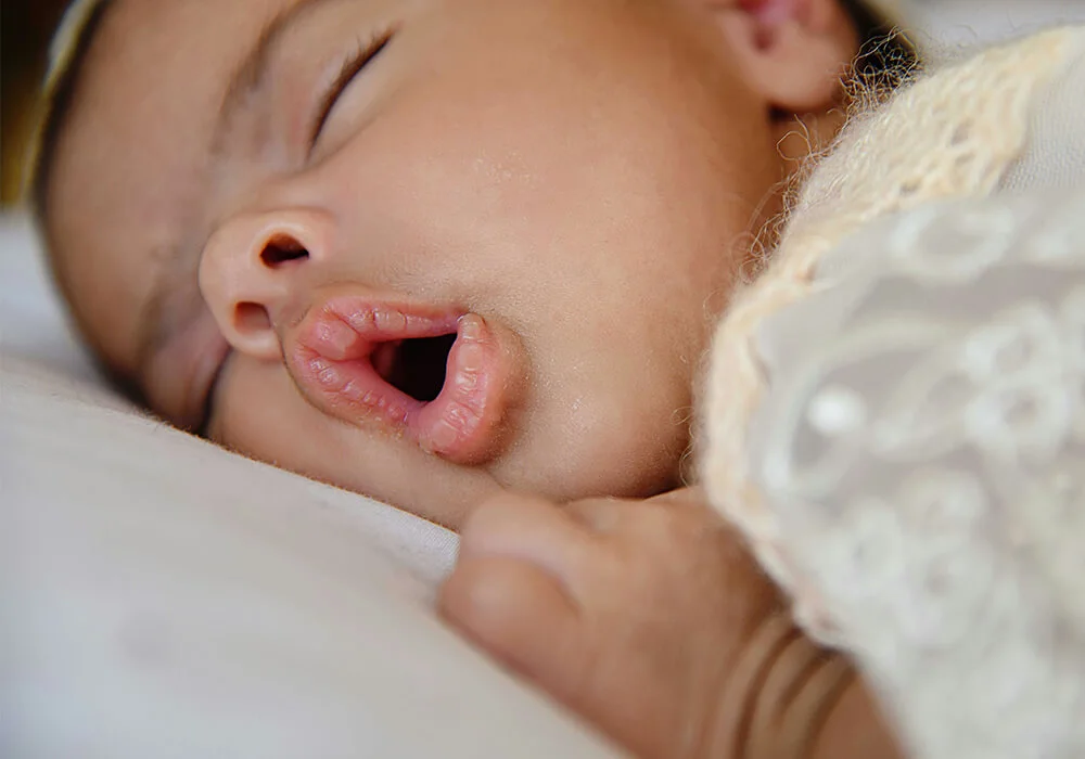 What is an Oral Dysfunction clinic and how is it different to a Tongue tie clinic?